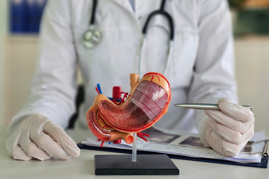 Bypass Gastric în Turcia