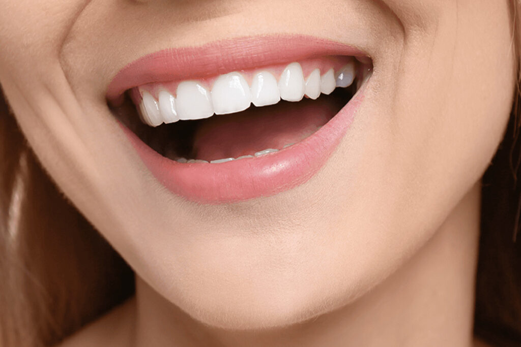 Hollywood Smile în Turcia