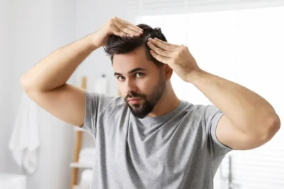 hair-transplant-4